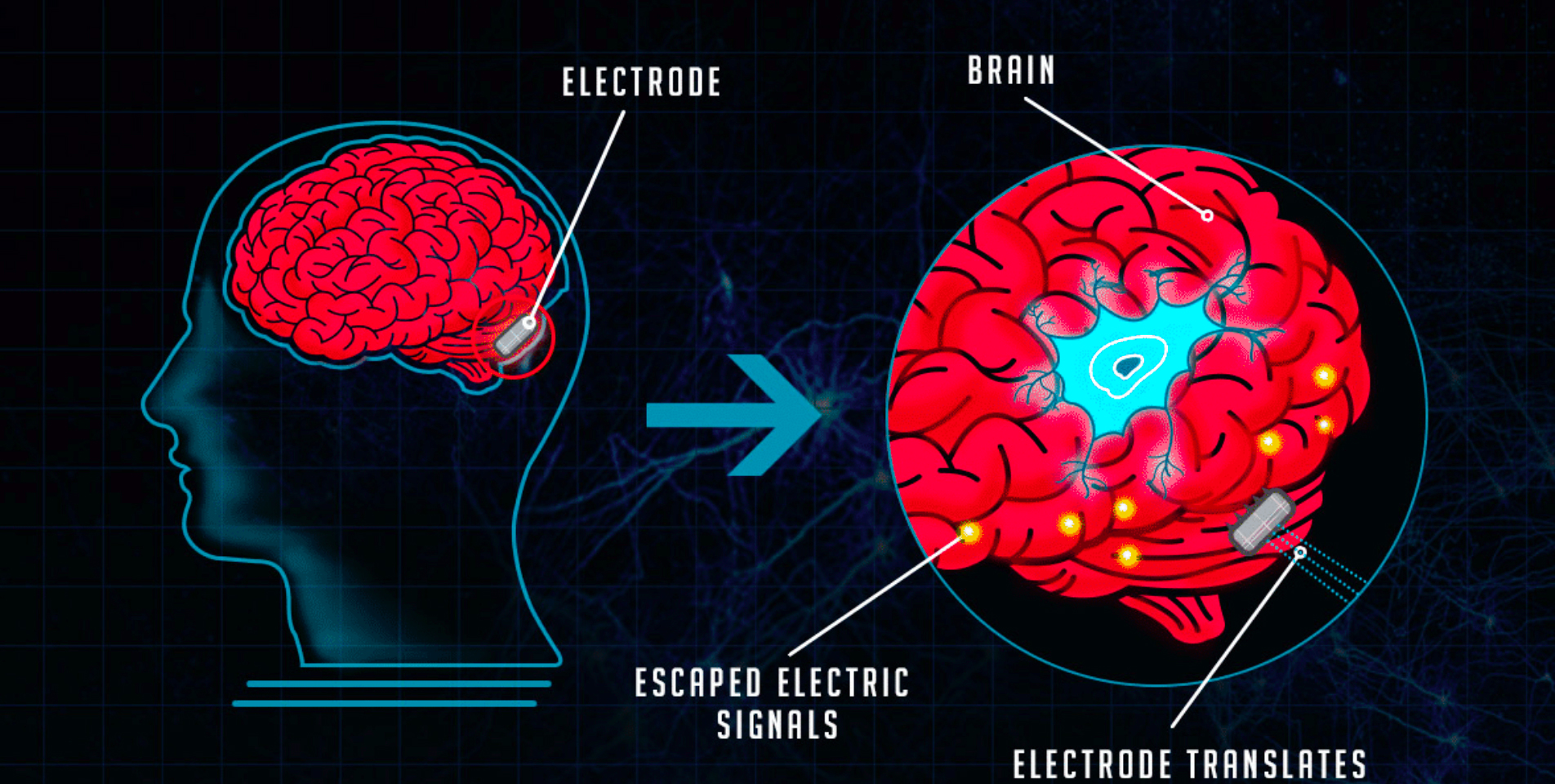 The evolution of Brain Computer Interface…. | antoniocerasa
